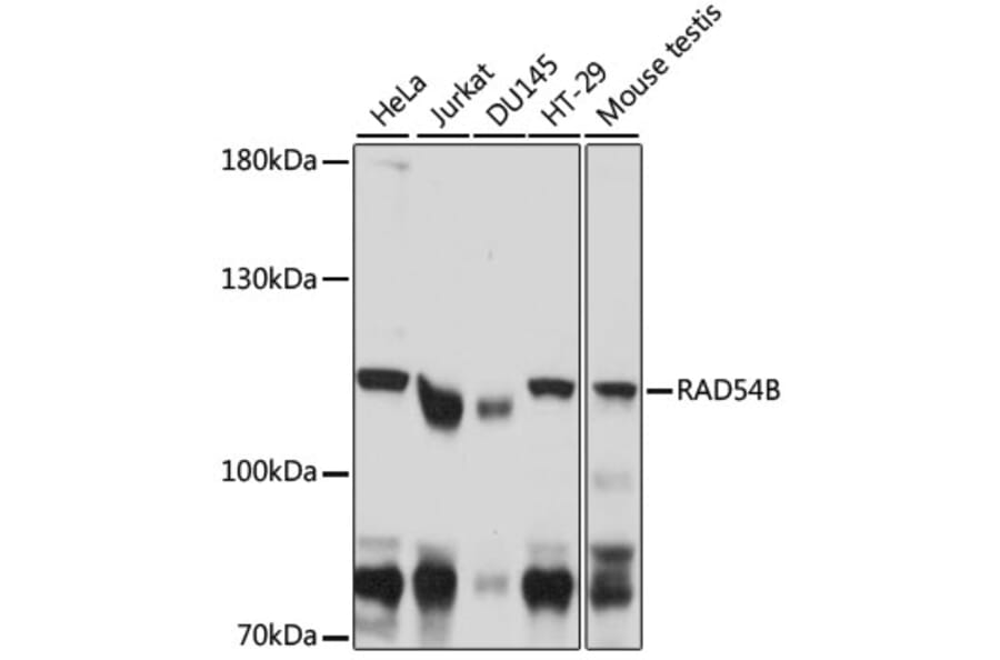 Western Blot - Anti-RAD54B Antibody (A87753) - Antibodies.com