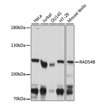 Western Blot - Anti-RAD54B Antibody (A87753) - Antibodies.com