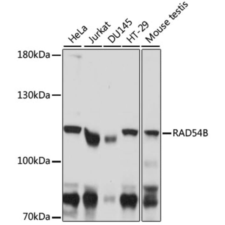 Western Blot - Anti-RAD54B Antibody (A87753) - Antibodies.com