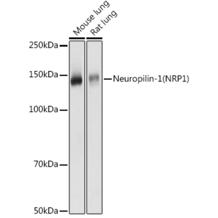 Western Blot - Anti-Neuropilin 1 Antibody (A87754) - Antibodies.com