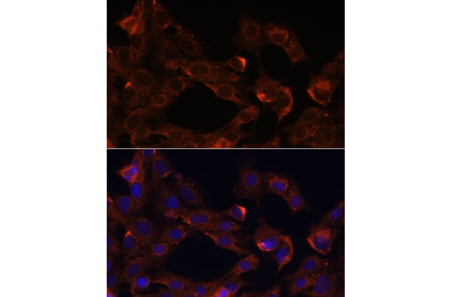 Immunofluorescence - Anti-Neuropilin 1 Antibody (A87754) - Antibodies.com