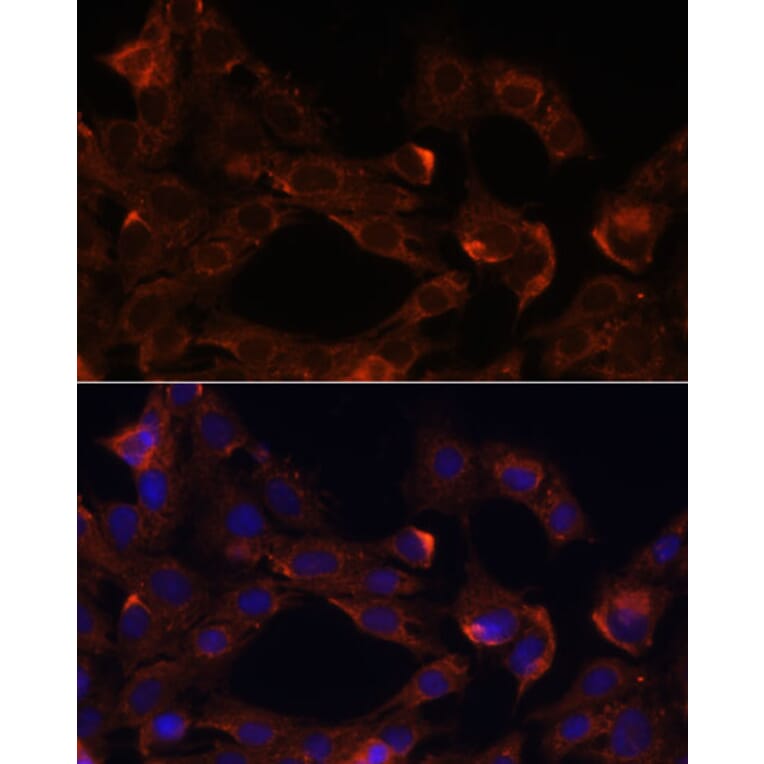 Immunofluorescence - Anti-Neuropilin 1 Antibody (A87754) - Antibodies.com