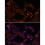 Immunofluorescence - Anti-Neuropilin 1 Antibody (A87754) - Antibodies.com