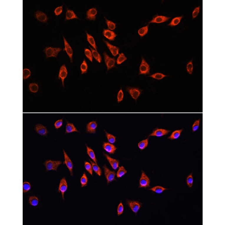 Immunofluorescence - Anti-Neuropilin 1 Antibody (A87754) - Antibodies.com