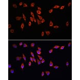 Immunofluorescence - Anti-Neuropilin 1 Antibody (A87754) - Antibodies.com