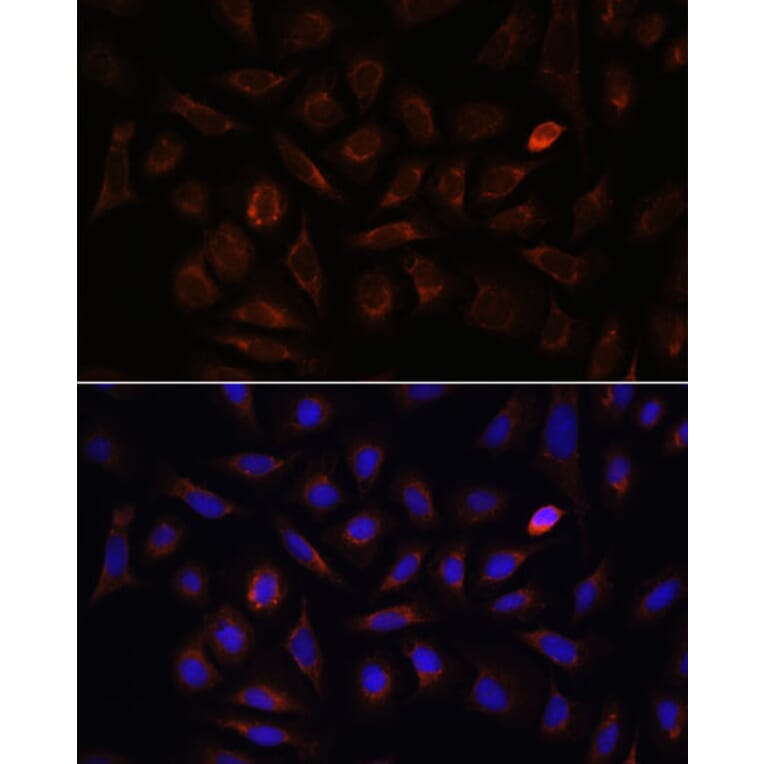 Immunofluorescence - Anti-Neuropilin 1 Antibody (A87754) - Antibodies.com