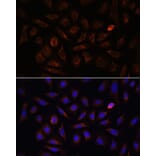 Immunofluorescence - Anti-Neuropilin 1 Antibody (A87754) - Antibodies.com