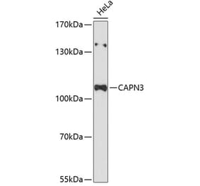 Western Blot - Anti-Calpain 3 Antibody (A87755) - Antibodies.com
