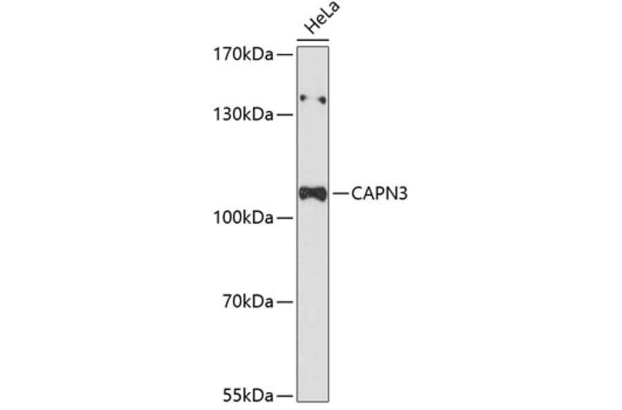 Western Blot - Anti-Calpain 3 Antibody (A87755) - Antibodies.com