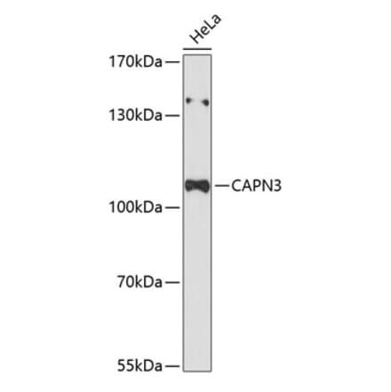 Western Blot - Anti-Calpain 3 Antibody (A87755) - Antibodies.com