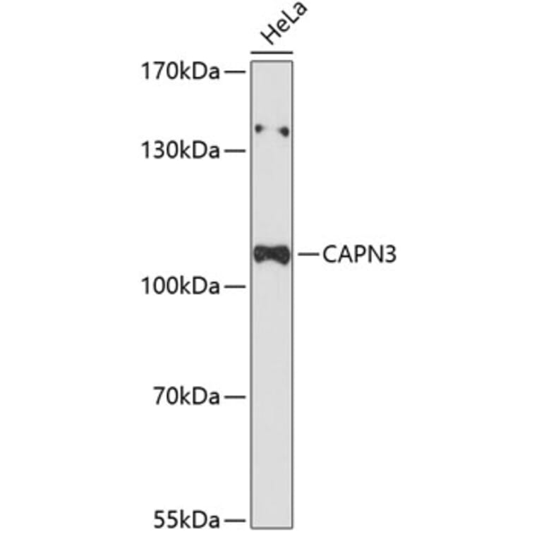 Western Blot - Anti-Calpain 3 Antibody (A87755) - Antibodies.com