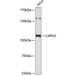 Western Blot - Anti-Calpain 3 Antibody (A87755) - Antibodies.com