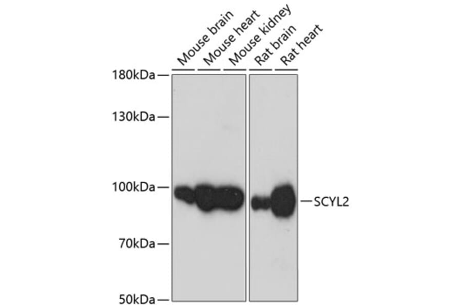 Western Blot - Anti-SCYL2 Antibody (A87756) - Antibodies.com