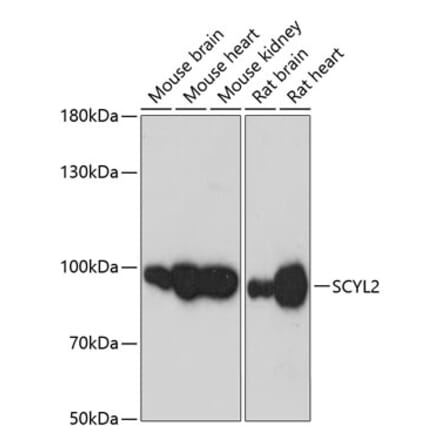 Western Blot - Anti-SCYL2 Antibody (A87756) - Antibodies.com