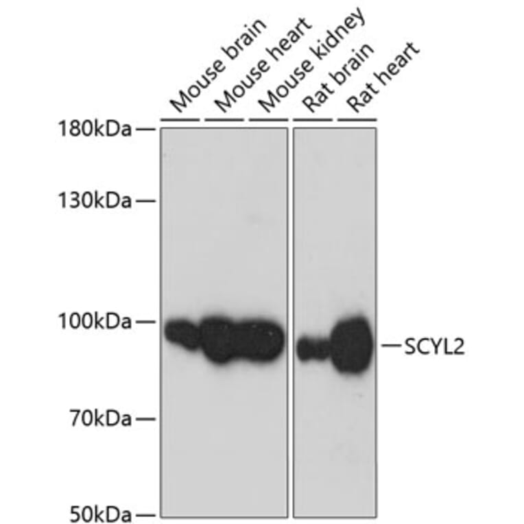 Western Blot - Anti-SCYL2 Antibody (A87756) - Antibodies.com