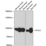 Western Blot - Anti-SCYL2 Antibody (A87756) - Antibodies.com