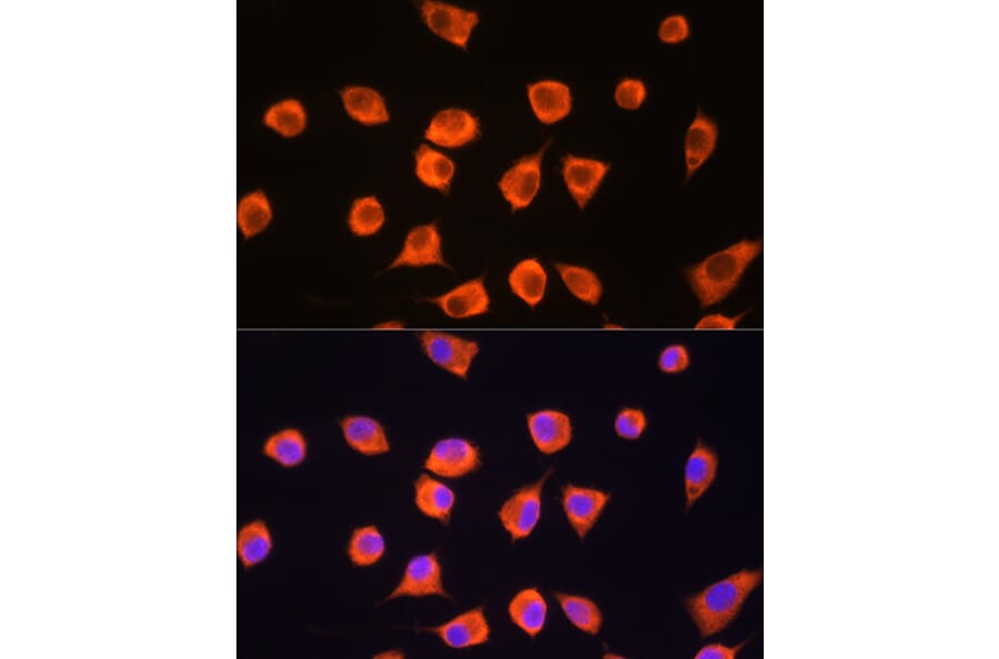 Immunofluorescence - Anti-SCYL2 Antibody (A87756) - Antibodies.com