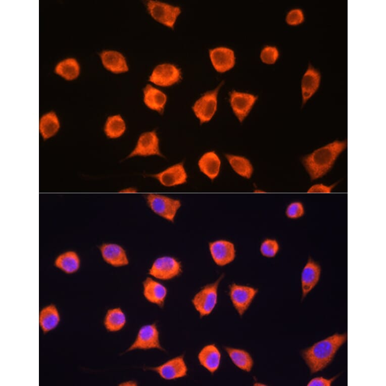 Immunofluorescence - Anti-SCYL2 Antibody (A87756) - Antibodies.com