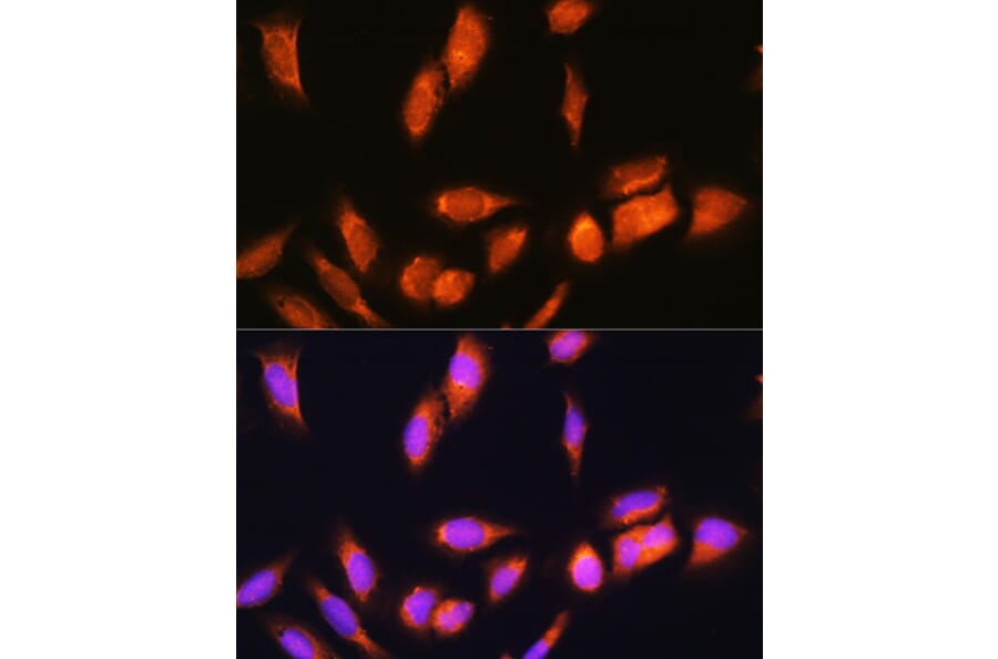Immunofluorescence - Anti-SCYL2 Antibody (A87756) - Antibodies.com