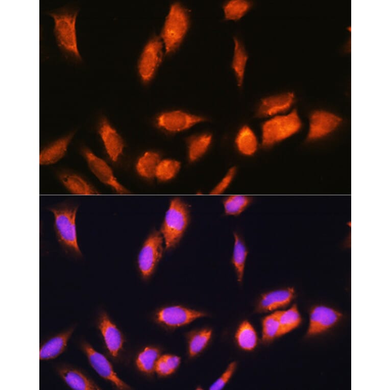 Immunofluorescence - Anti-SCYL2 Antibody (A87756) - Antibodies.com