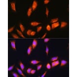 Immunofluorescence - Anti-SCYL2 Antibody (A87756) - Antibodies.com