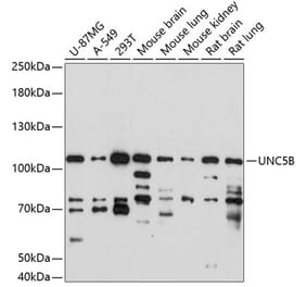 Western Blot - Anti-UNC5B Antibody (A87757) - Antibodies.com