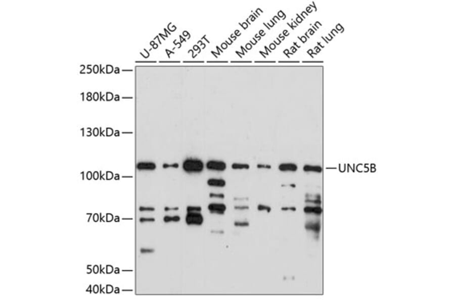 Western Blot - Anti-UNC5B Antibody (A87757) - Antibodies.com