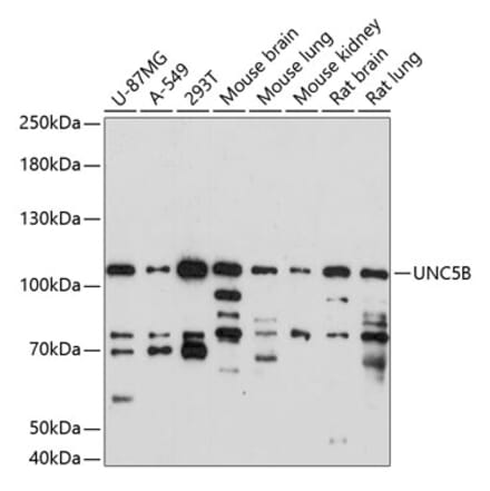 Western Blot - Anti-UNC5B Antibody (A87757) - Antibodies.com