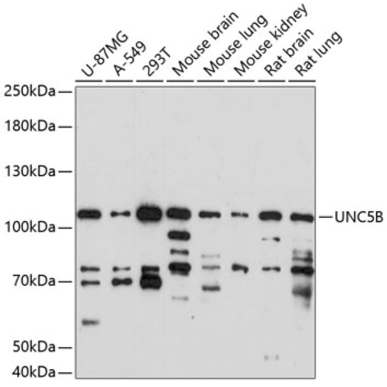 Western Blot - Anti-UNC5B Antibody (A87757) - Antibodies.com