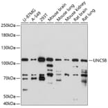Western Blot - Anti-UNC5B Antibody (A87757) - Antibodies.com