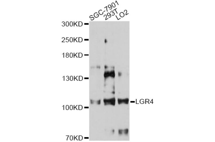 Western Blot - Anti-LGR4 Antibody (A12658) - Antibodies.com