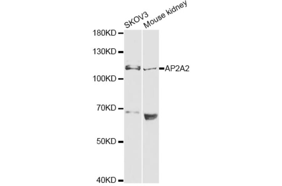 Western Blot - Anti-AP2A2 Antibody (A13274) - Antibodies.com