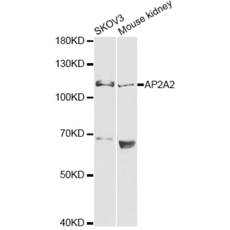 Western Blot - Anti-AP2A2 Antibody (A13274) - Antibodies.com