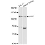 Western Blot - Anti-AP2A2 Antibody (A13274) - Antibodies.com