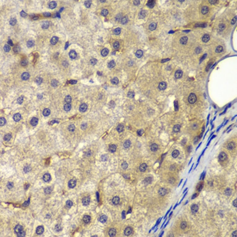Immunohistochemistry - Anti-AP2A2 Antibody (A13274) - Antibodies.com
