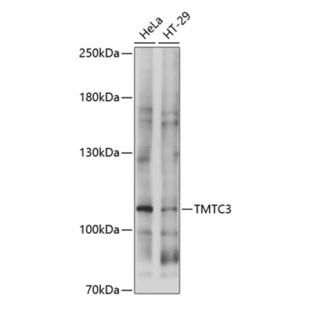 Western Blot - Anti-TMTC3 Antibody (A87760) - Antibodies.com