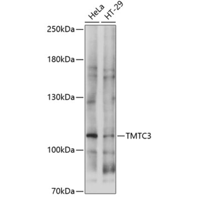 Western Blot - Anti-TMTC3 Antibody (A87760) - Antibodies.com
