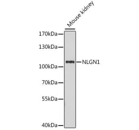 Western Blot - Anti-Neuroligin 1 Antibody (A87761) - Antibodies.com