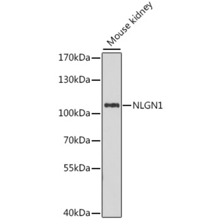 Western Blot - Anti-Neuroligin 1 Antibody (A87761) - Antibodies.com