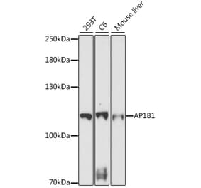 Western Blot - Anti-AP1B1 Antibody (A87763) - Antibodies.com