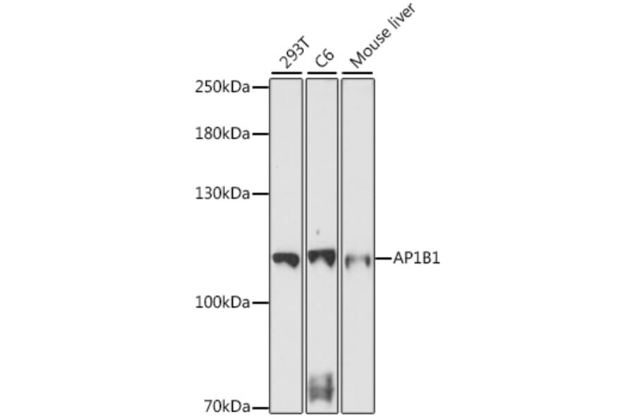 Western Blot - Anti-AP1B1 Antibody (A87763) - Antibodies.com