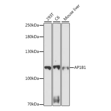 Western Blot - Anti-AP1B1 Antibody (A87763) - Antibodies.com