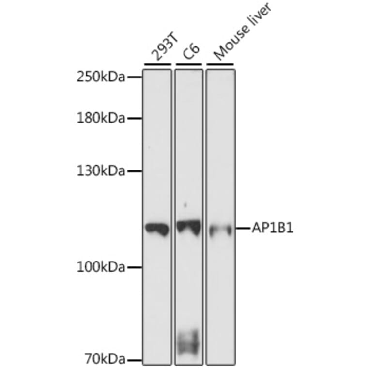 Western Blot - Anti-AP1B1 Antibody (A87763) - Antibodies.com