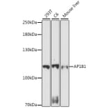 Western Blot - Anti-AP1B1 Antibody (A87763) - Antibodies.com