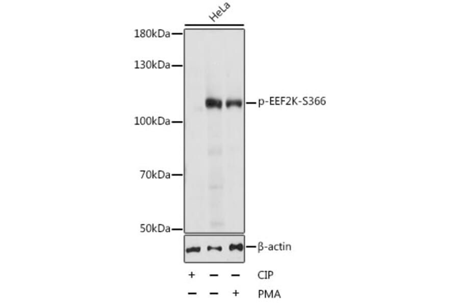 Western Blot - Anti-EEF2K (phospho Ser366) Antibody (A87764) - Antibodies.com