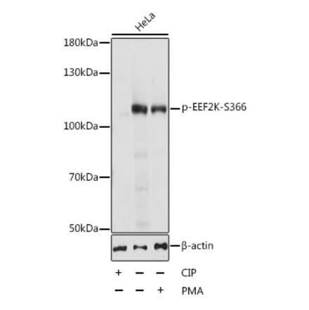 Western Blot - Anti-EEF2K (phospho Ser366) Antibody (A87764) - Antibodies.com