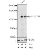 Western Blot - Anti-EEF2K (phospho Ser366) Antibody (A87764) - Antibodies.com