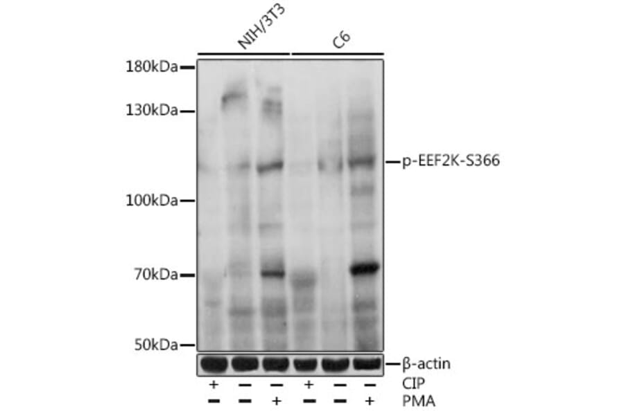 Western Blot - Anti-EEF2K (phospho Ser366) Antibody (A87764) - Antibodies.com