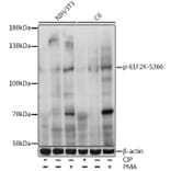 Western Blot - Anti-EEF2K (phospho Ser366) Antibody (A87764) - Antibodies.com