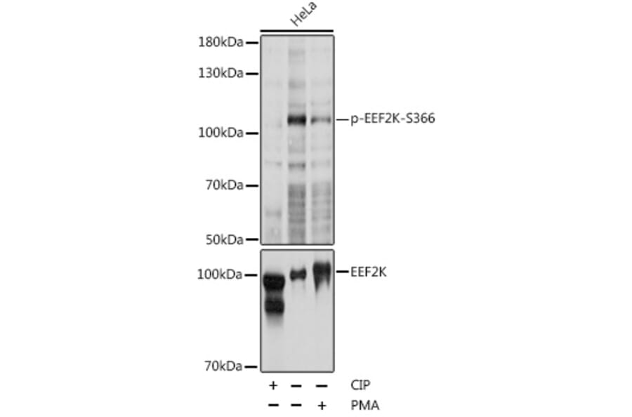Western Blot - Anti-EEF2K (phospho Ser366) Antibody (A87764) - Antibodies.com